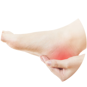 Heel Pain: How to treat Plantar Fasciitis